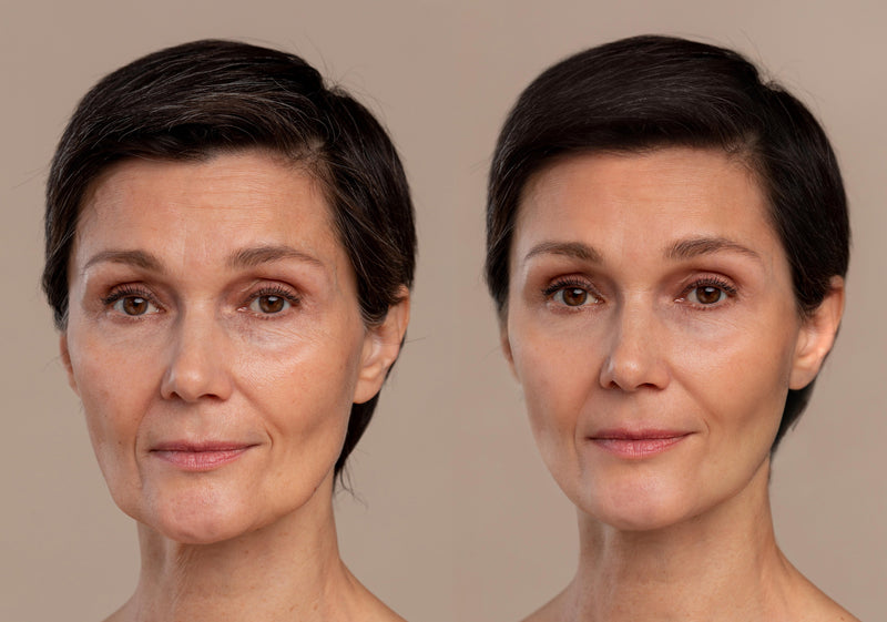 Visible Age Reverse